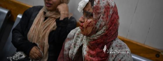 بالصور:  لليوم الثاني عشر تغطية متواصلة للحرب على غزة من جنوب قطاع غزة