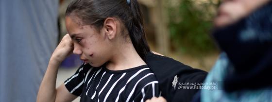 قصة مصورة : الطفلة " تالا " الناجية الوحيدة من المجزرة التي ارتكبها الاحتلال بحق عائلتها الذين ارتقوا جميعم، بعد تدمير المنزل كاملا عليهم شرق مدينة خانيونس.