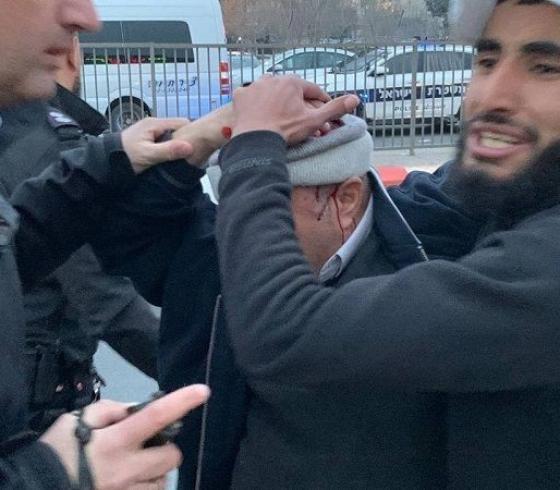 إصابة مسن فلسطيني بجراح جراء اعتداءات المستوطنين في باب العامود