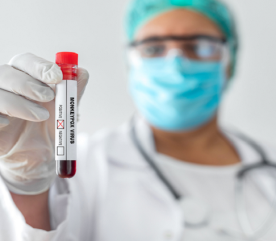 دراسة تزعم أن عقارا لجدري القردة يقلل من مدة الأعراض!
