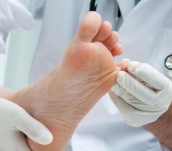 ماهي أخطر الأماكن لانتقال عدوى الفطريات؟ طبيب يجيب