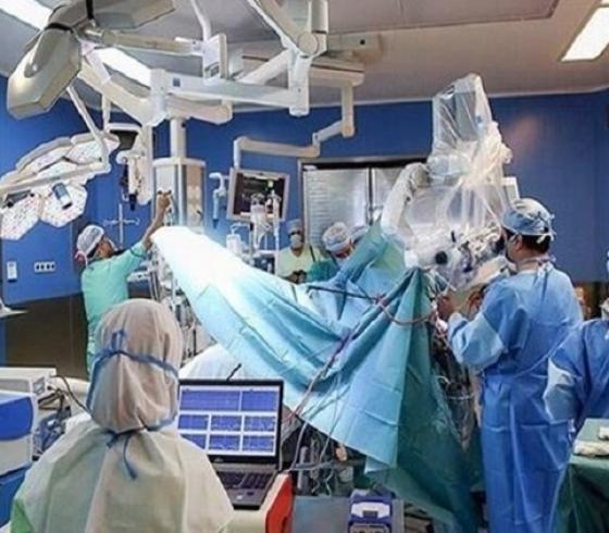 نجاح أول عملية وصل رأس في إيران