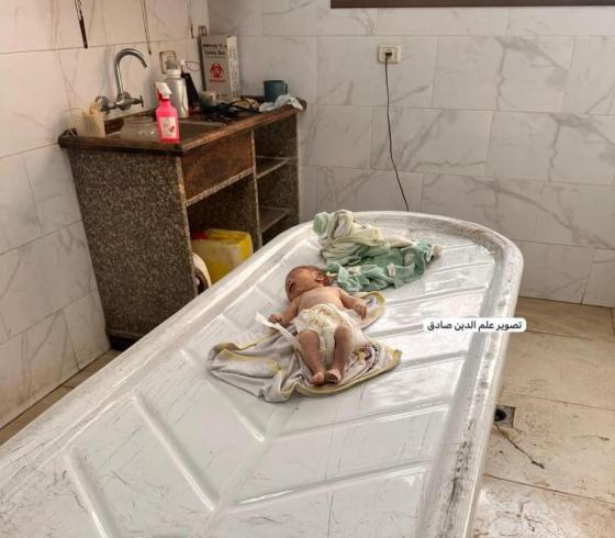 وفاة رضيعة في غزة (أرشيفية)
