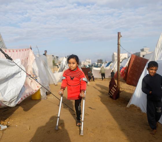 طفلة مبترة القدم جراء العدوان الإسرائيلي على غزة.jpeg