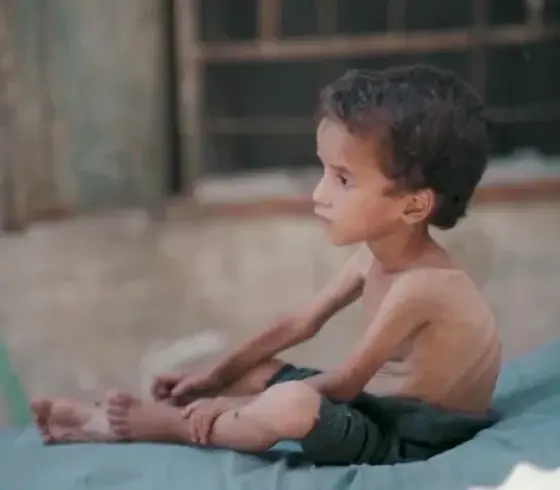 تجويع غزة