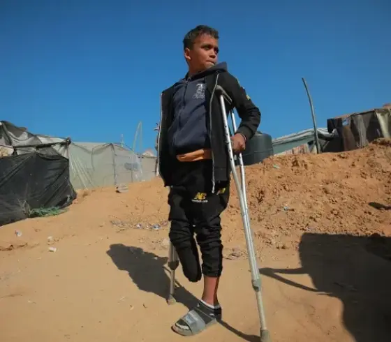 طفل مبتور الساق في غزة