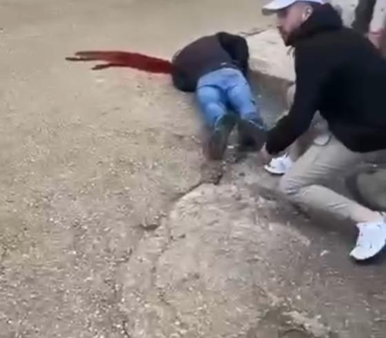 إصابة خطيرة في قلنديا