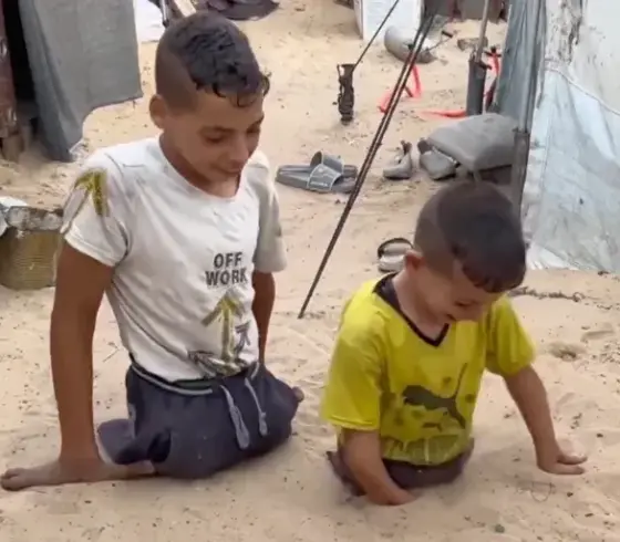 طفلان غزيان مبتورا الأطراف جراء استهدافهما بالصواريخ الإسرائيلية خلال حرب الإبادة