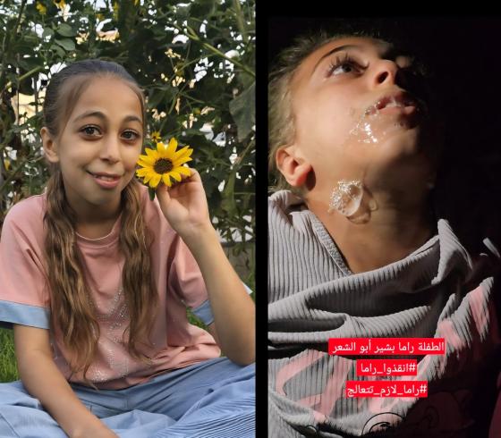 الطفلة راما