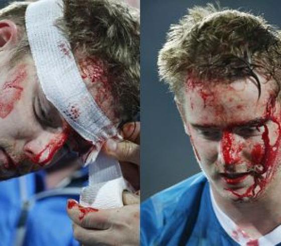 لاعب ينجو من الموت بعد أعنف تدخل يمكن أن تشاهده