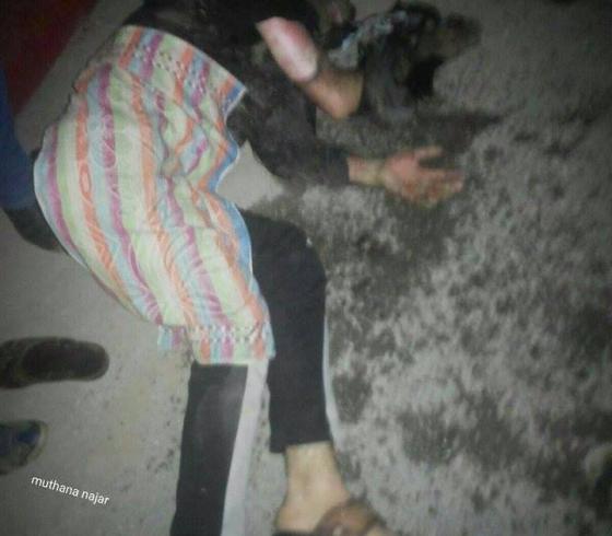 المواطن الذي احرق نفسه