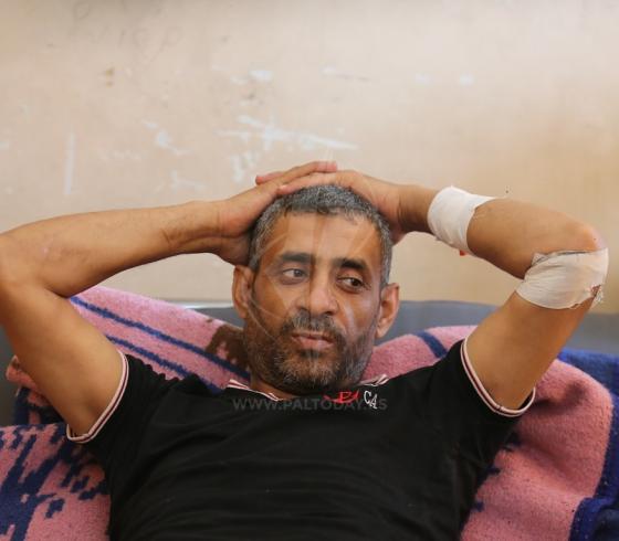 الجريح الترك ‫(41419267)‬ ‫‬.JPG