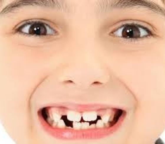 اسنان الاطفال