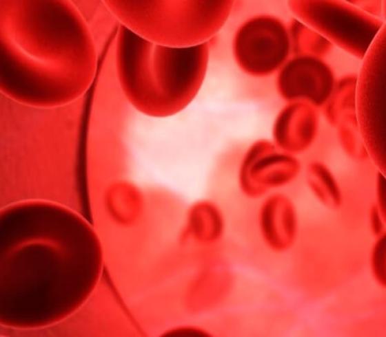 Thalassemia