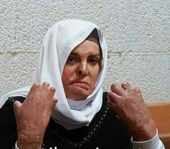 اسراء الجعابيص