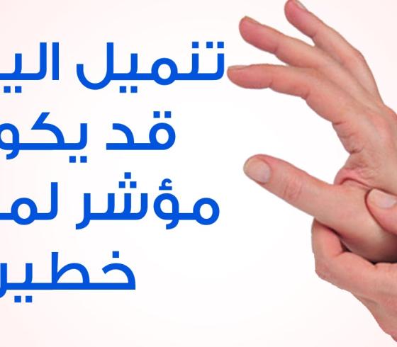 تنميل اليدين