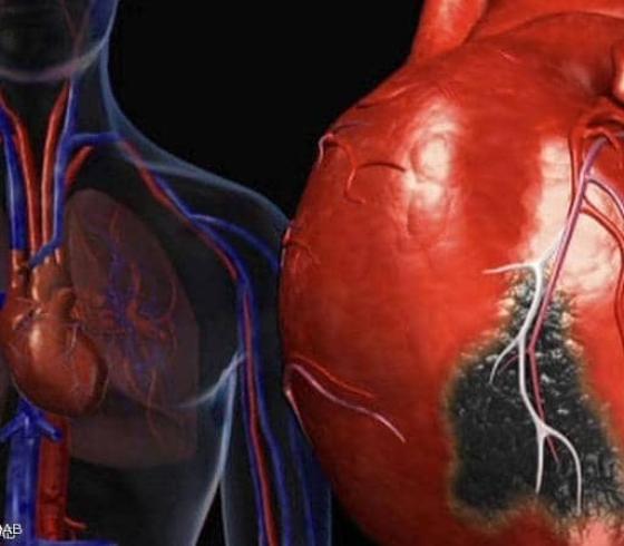 رفع الأثقال مفيد لحرق دهون القلب