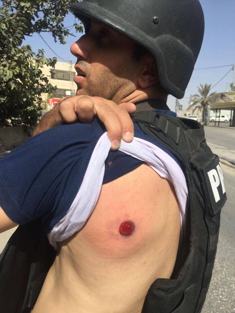جانب من إصابة الصحفي  مجدي محمد 