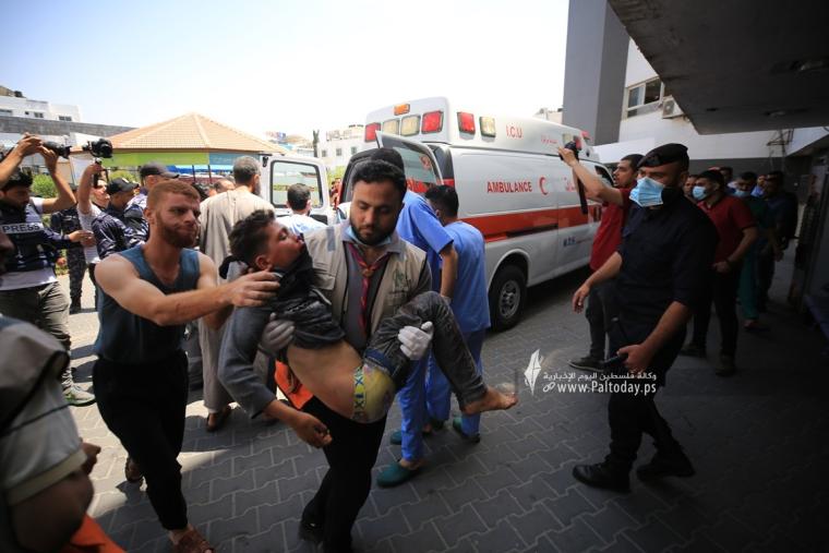 اصابة اطفال معركة سيف القدس (1).JPG