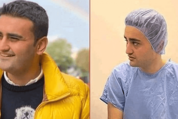 الشف التركي.png