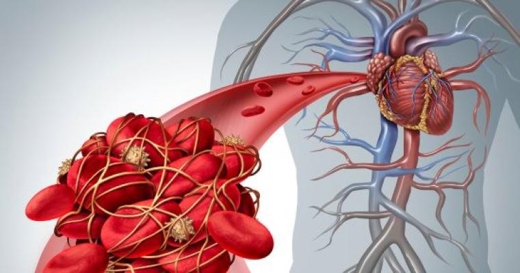أفضل 5 أطعمة تساعد في تدفق الدورة الدموية