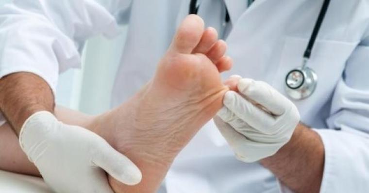 ماهي أخطر الأماكن لانتقال عدوى الفطريات؟ طبيب يجيب