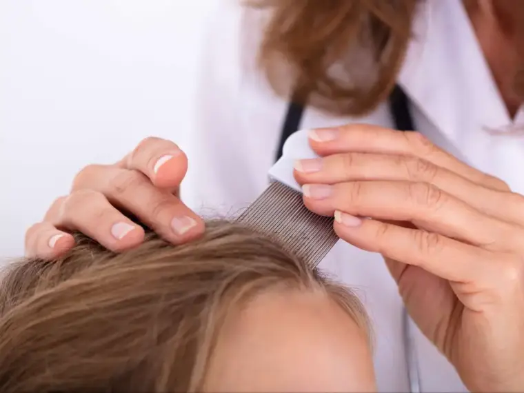 تفسير حلم القمل في المنام وقتله للمتزوجة