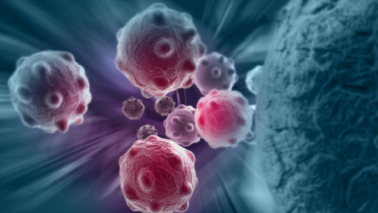 صورة توضيحية- خلايا سرطان