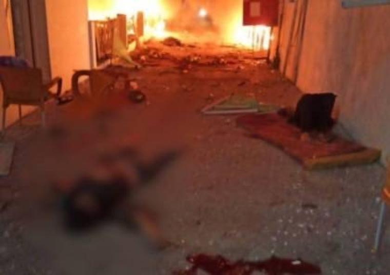 مستشفى المعمداني بعد قصف الإحتلال الإسرائيلي