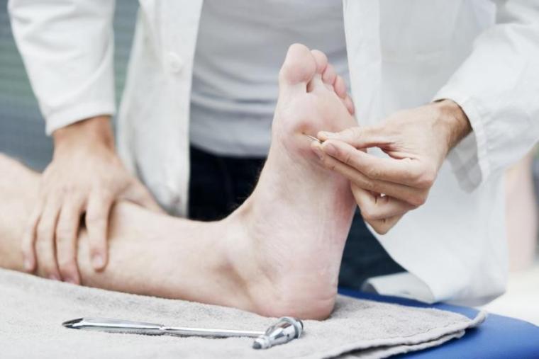 علاج مشاكل الأعصاب
