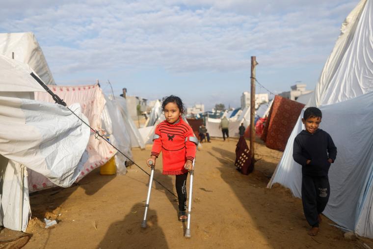 طفلة مبترة القدم جراء العدوان الإسرائيلي على غزة.jpeg
