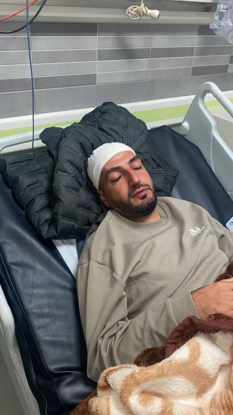 الاحتلال يصيب شابا بقنبلة غاز في رأسه ببلدة الرام شمال القدس