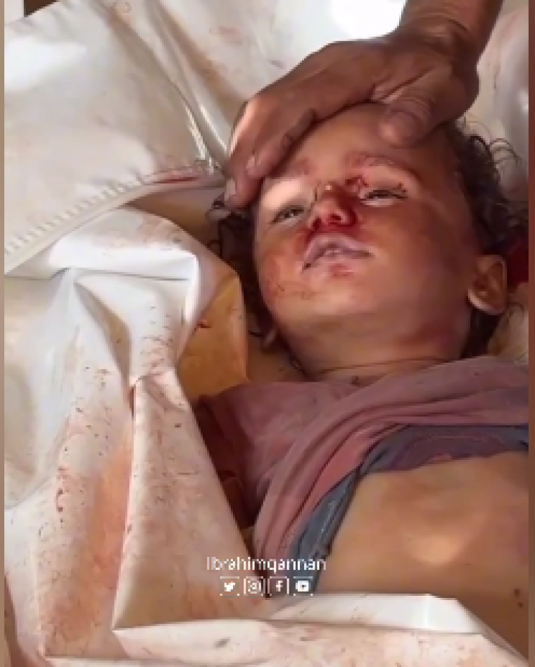 أطفال شهداء.PNG