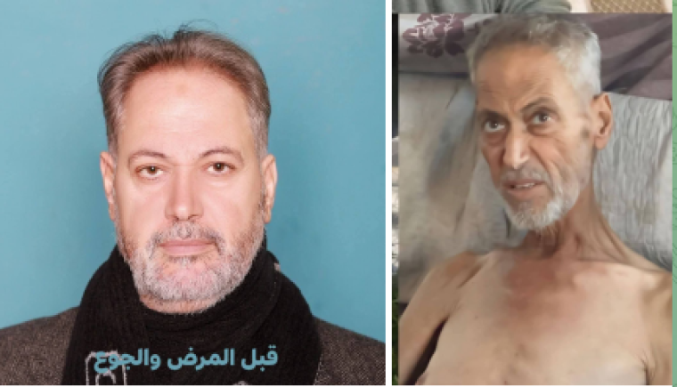استشهاد الكاتب الدكتور عمر حرب بسبب سوء التغذية في غزة