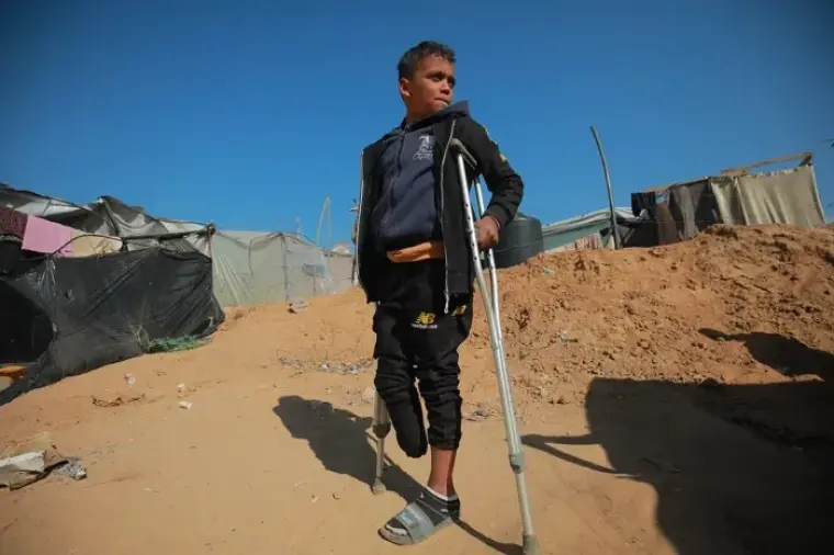 طفل مبتور الساق في غزة