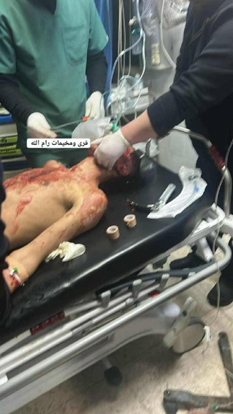 اصابة خطيرةة في بني زيد