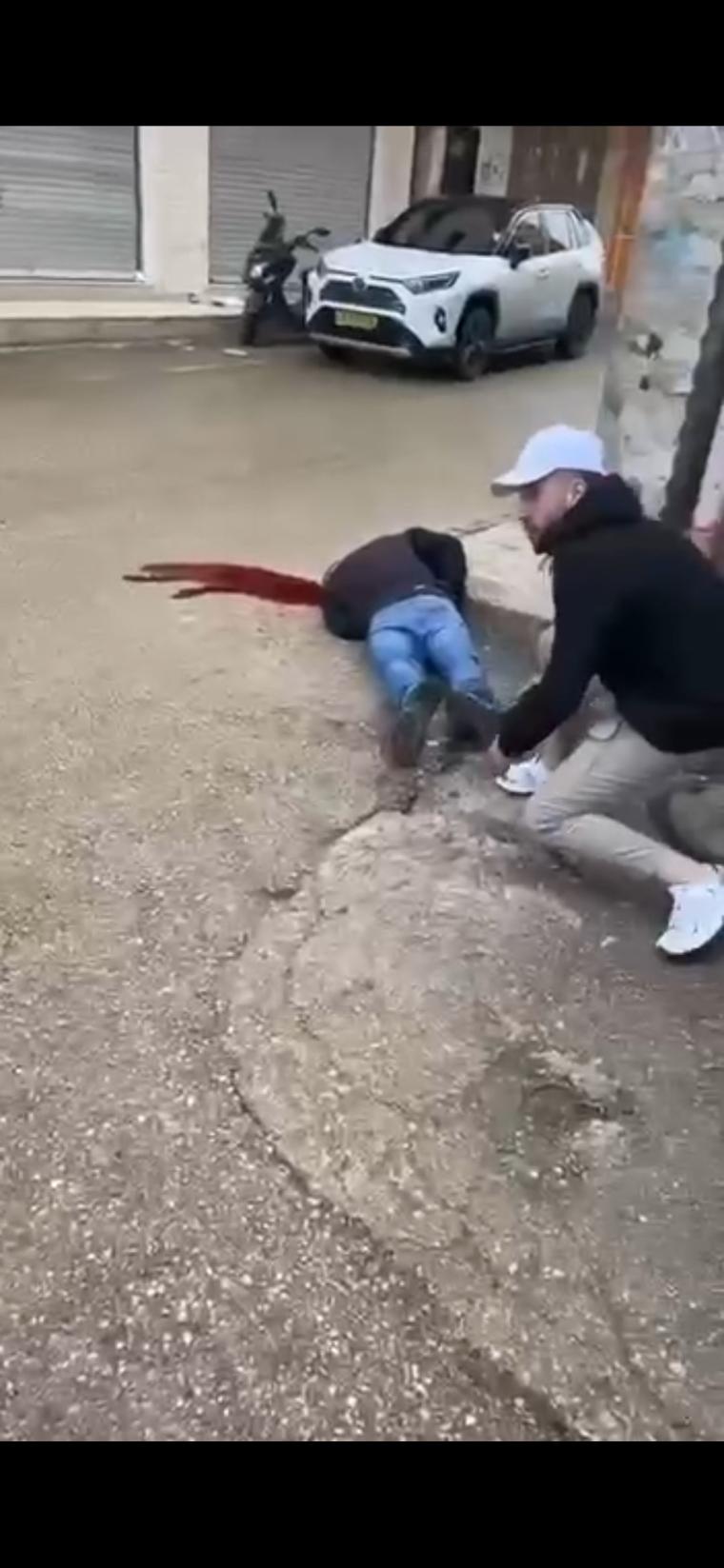 إصابة خطيرة في قلنديا