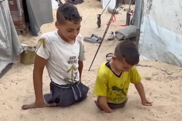 طفلان غزيان مبتورا الأطراف جراء استهدافهما بالصواريخ الإسرائيلية خلال حرب الإبادة