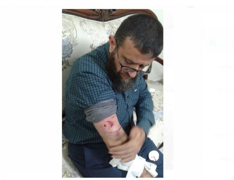 الشيخ خضر عدنان اصيب بقنبلة غاز.JPG