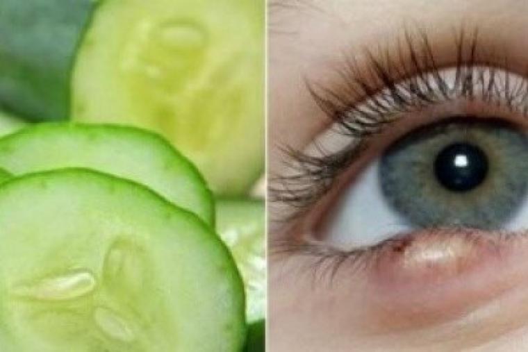 علاج دمامل العين