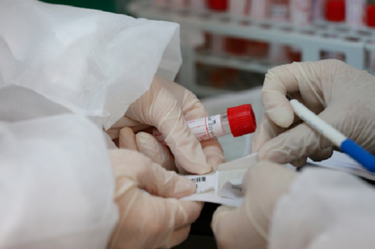 صحة رام الله: توفير مواد فحص فيروس "كورونا" في مختبرات الوزارة