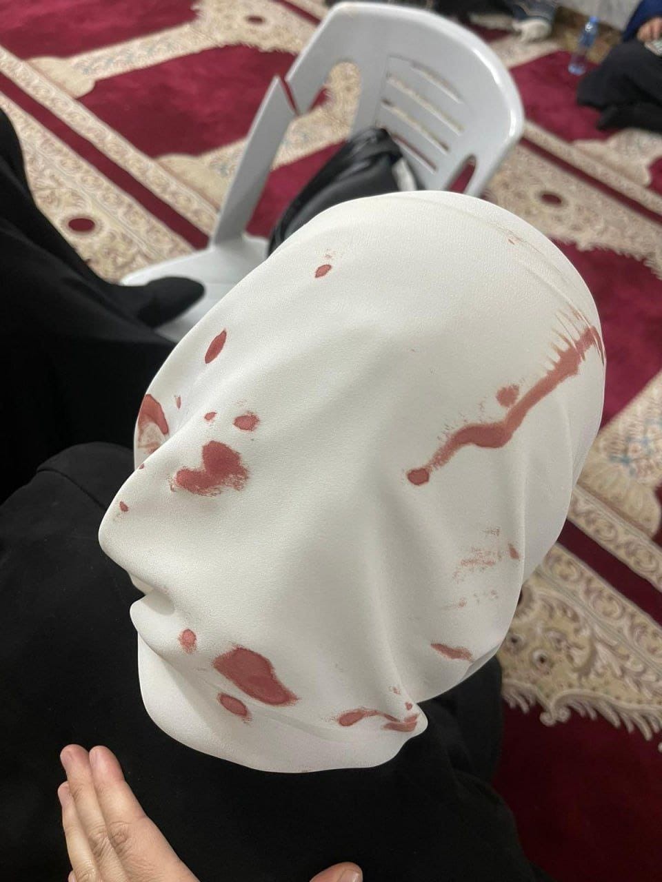 إصابة سيدة في المسجد الأقصى اليوم