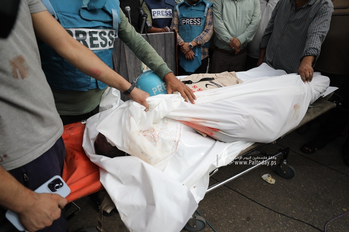  الزميل الصحفي في قناة فلسطين اليوم محمد بعلوشة جراء قصف اسرائيلي استهدف منزله  شمال غزة (11).JPG