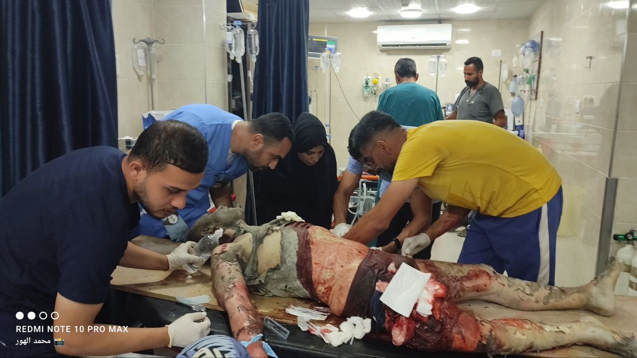 اصابات بقصف اسرائيلي في قطاع غزة