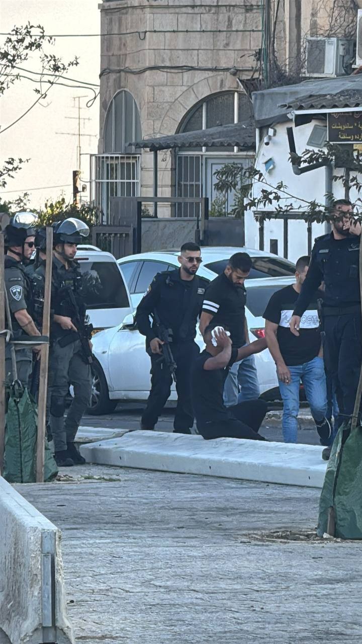 اصابة شاب في القدس 